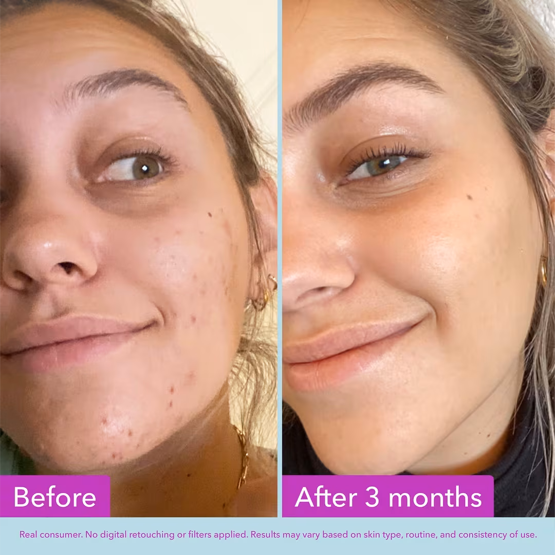 Niacinamide Brightening Toner