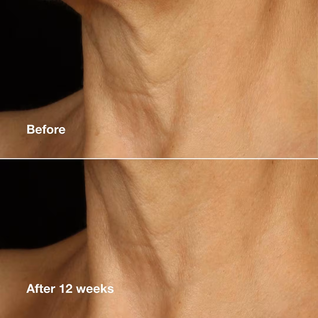 Smart Clinical Repair Lifting Face + Neck Cream