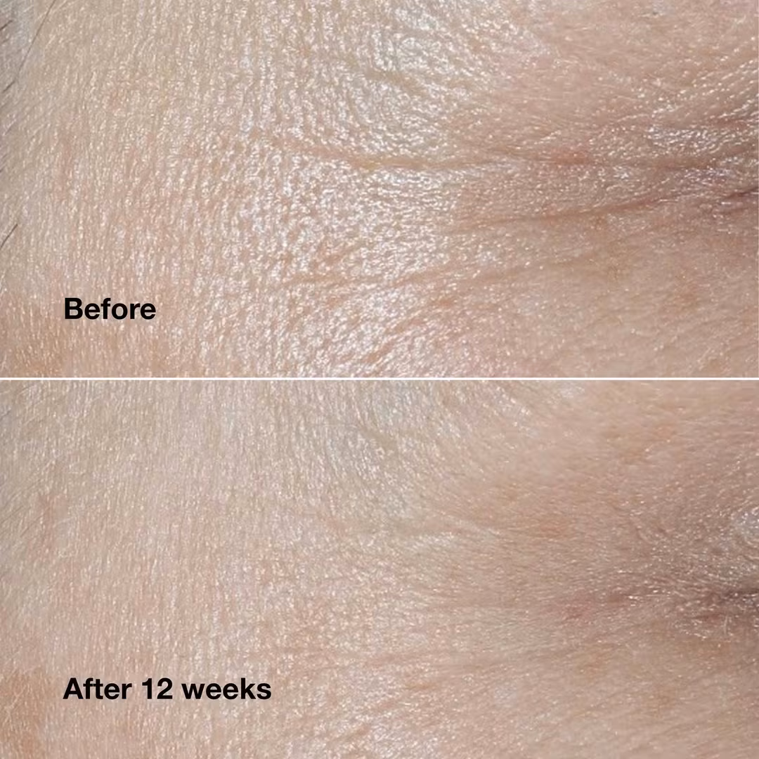 Smart Clinical Repair Wrinkle Correcting Face Cream
