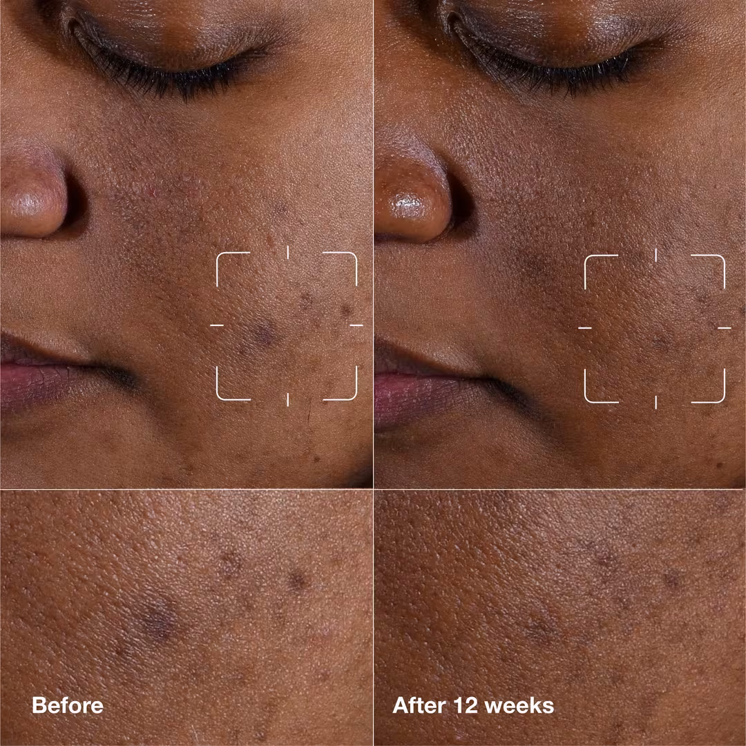 Even Better Clinical Dark Spot Clearing Serum with Vitamin C