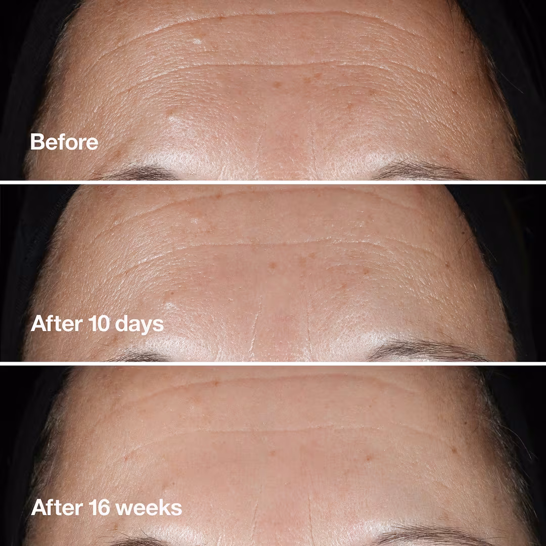 Clinique Smart Clinical Repair Wrinkle Correcting Serum