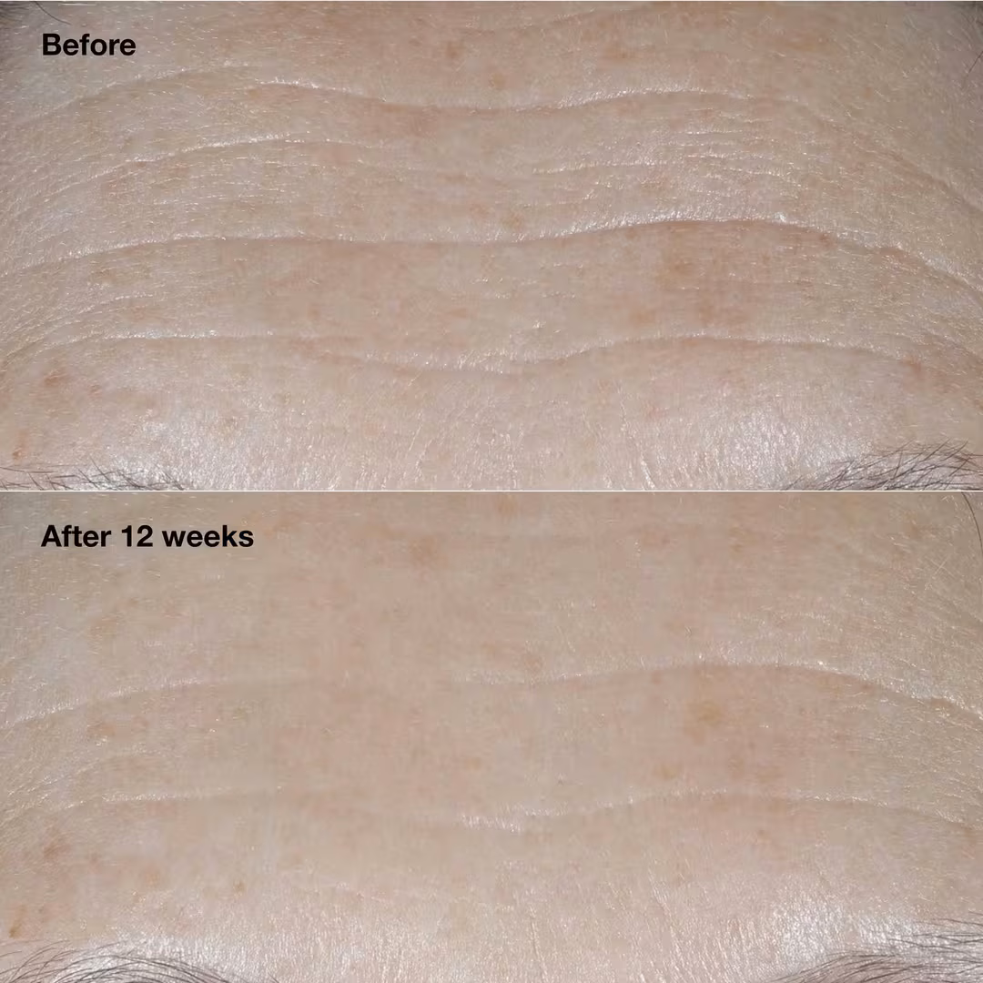 Smart Clinical Repair SPF 30 Wrinkle Correcting Cream
