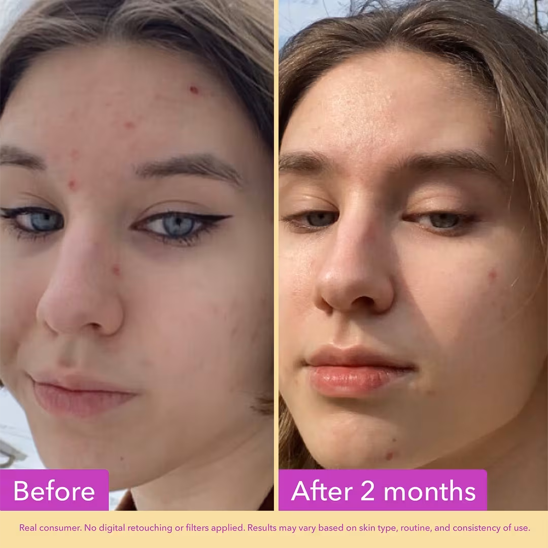 Niacinamide Serum