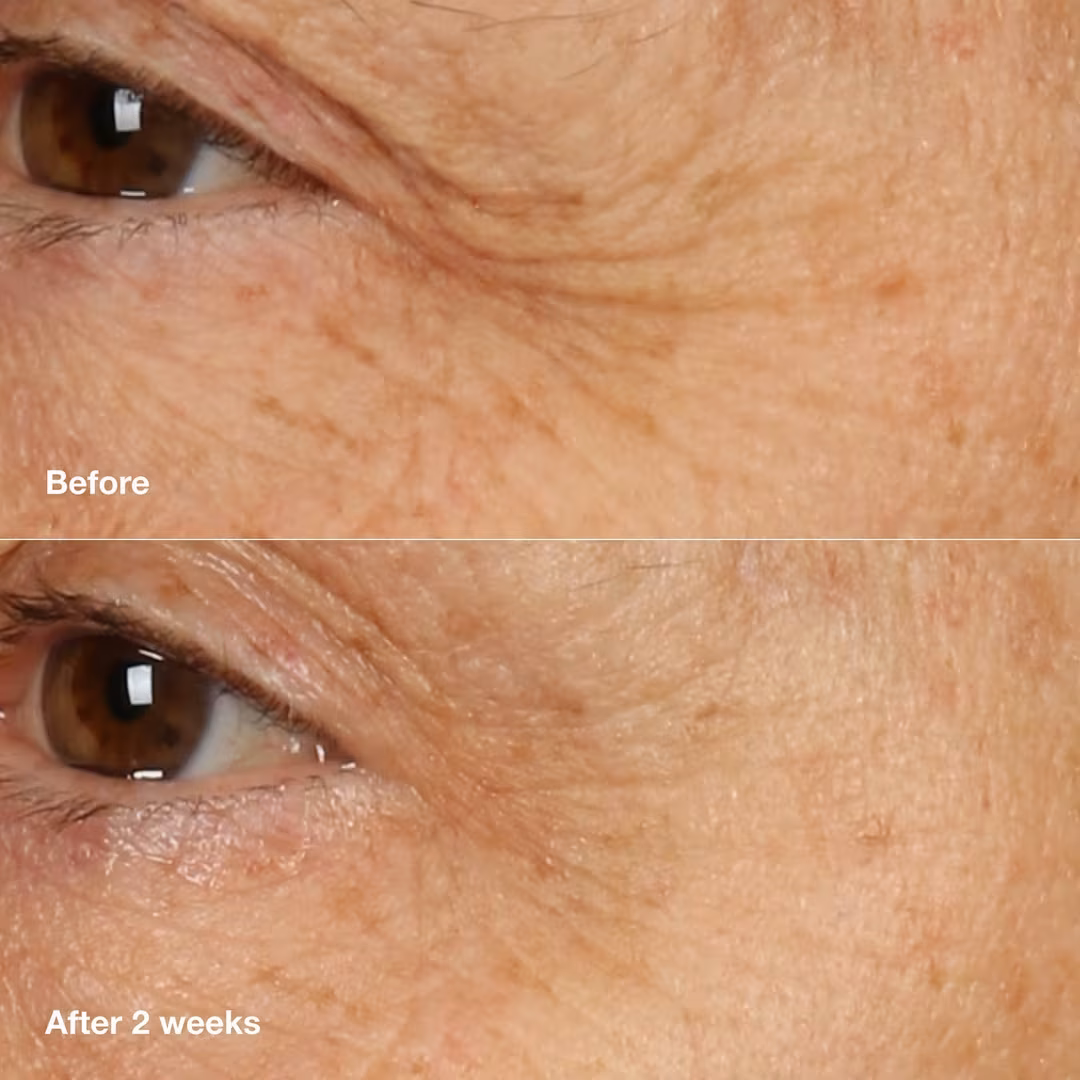 Smart Clinical Repair Overnight Recovery Face Cream + Mask