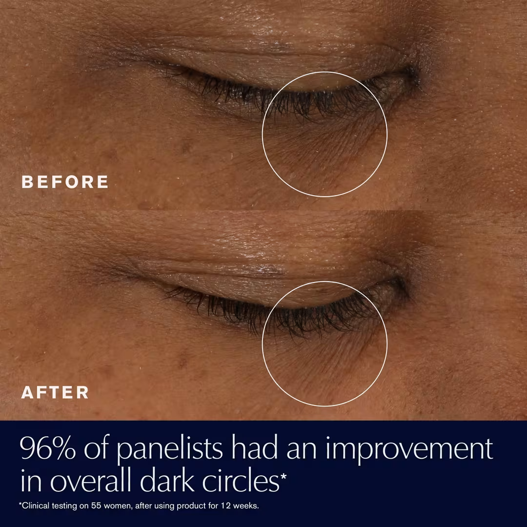Advanced Night Repair Eye Gel-Cream for Dark Circles