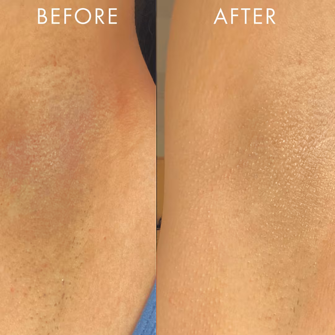 Coco Cloud Deodorant